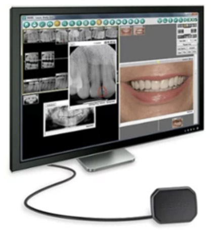 Digital radiography